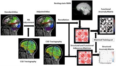 Application of Structural and Functional Connectome Mismatch for Classification and Individualized Therapy in Alzheimer Disease